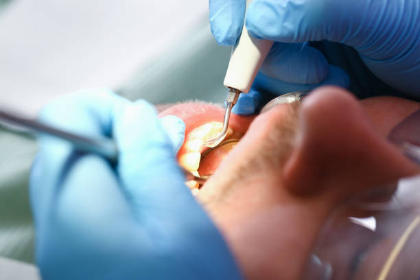 Best Cracked Tooth Emergency Dentist  in Wellington, UT
